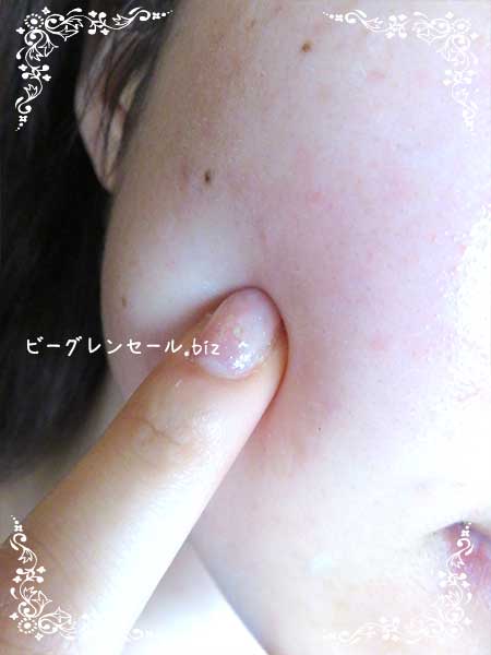 ビーグレン夏のプレゼント　体験談